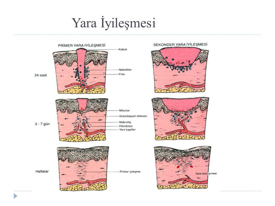 Yara İyileşmesi
